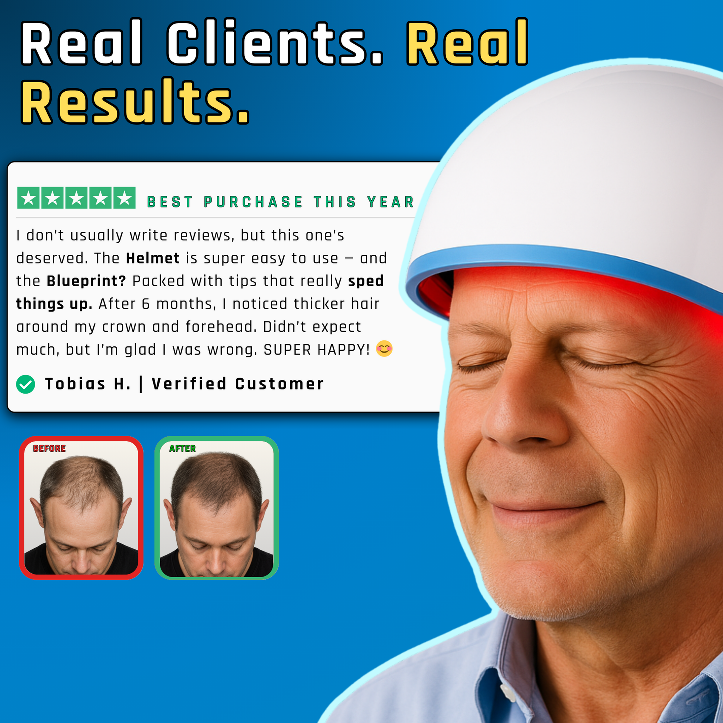 Biohair+ Helmet - Clinically Inspired Technology